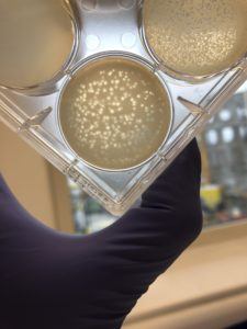 Phage (clear circles) killing the bacteria (cloudy parts of the dish)