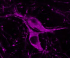 These are dopamine-producing nerve cells