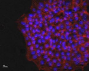 Fluorescent stem cell colony