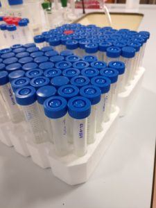 Rack of tubes of water sample ready for analysis