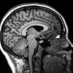 MRI scan of my brain