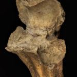 Osteoarthritis of the ulna
