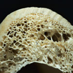 trabecular structure inside a bone.