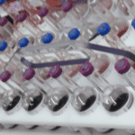 Photograph of blood culture bottles