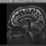 A photo of an adult human brain taken with an MRI scanner