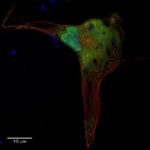 Microscope image of a cell with fluerescent red, blue and green areas