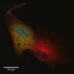 Microscope image of a cell with fluerescent red, blue and green areas