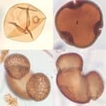 An image of pollen grains under a microscope