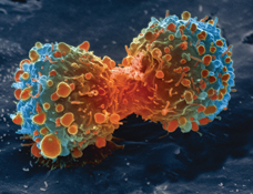 Lung cancer cell dividing | Image courtesy of US National Institute of Health